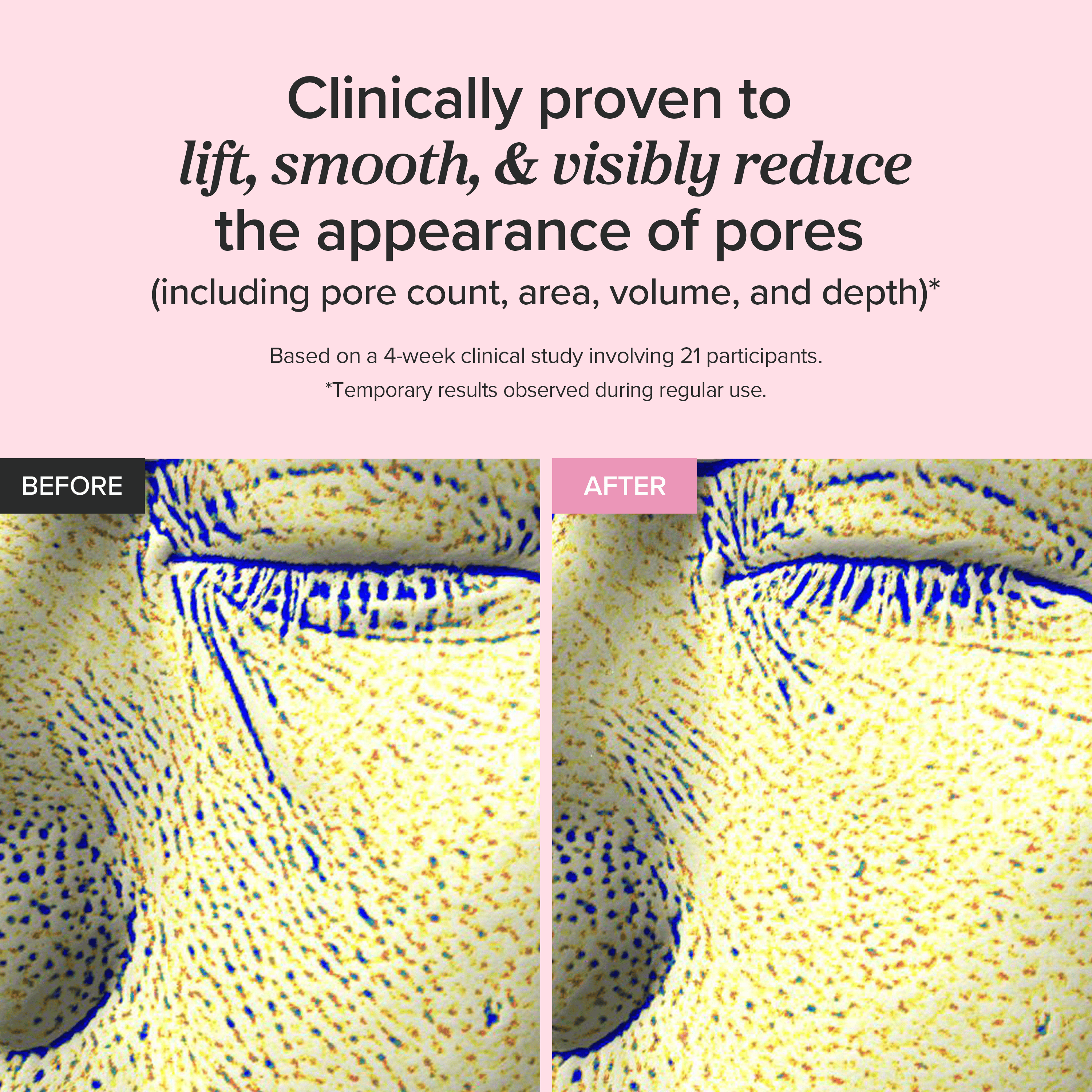 Beauty of Joseon Pore Firming Serum : Red Bean PDRN™ + Peptide